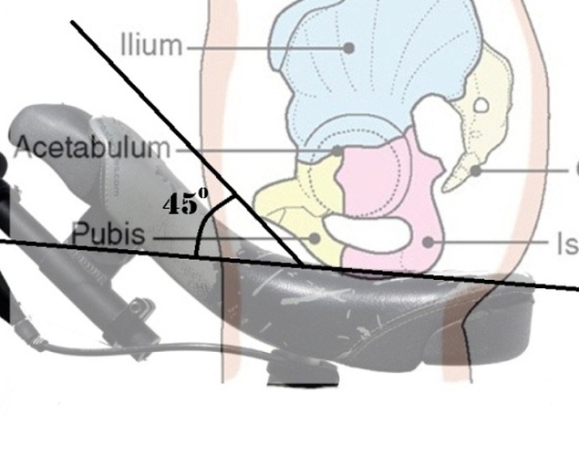 Pelvisoncurve-angles copy.jpg