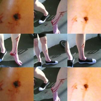 Bleeding Shin Collage Cross comp.jpg