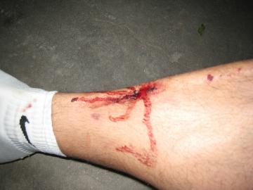 shin_bash.jpg