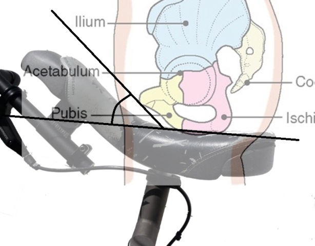 Pelvisoncurve-angles.jpg