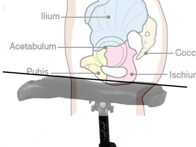 pelvisonflat-angles.jpg